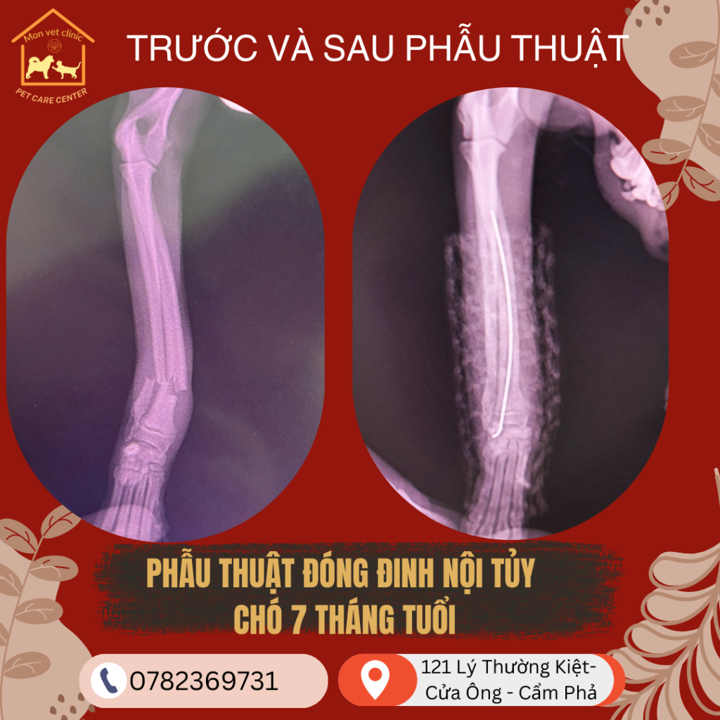 phau-thuat-gay-chan-o-cho